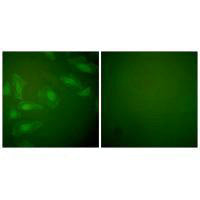 Immunofluorescence analysis of HeLa cells, using DJ-1 antibody.Rabbit anti-Human PARK7 Polyclonal Antibody