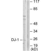 Western blot analysis of extracts from HuvEc cells, using DJ-1 antibody.Rabbit anti-Human PARK7 Polyclonal Antibody