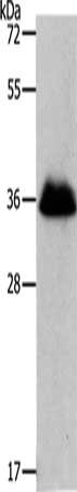 Gel: 12%SDS-PAGE, Lysate: 30 μg, Lane: NIH/3T3 cells, Primary antibody: RNF126 Antibody(RNF126 Antibody) at dilution 1/1050, Secondary antibody: Goat anti rabbit IgG at 1/8000 dilution, Exposure time: 2 secondsRabbit anti-Human RNF126 Polyclonal Antibody