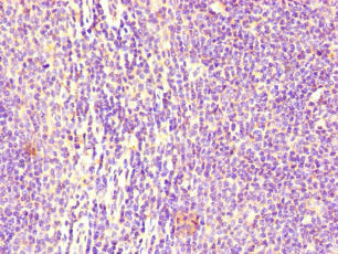 Immunohistochemistry of paraffin-embedded human lymph node tissue using FCGR2B Antibody at dilution of 1:100Rabbit anti-Human FCGR2B Polyclonal Antibody
