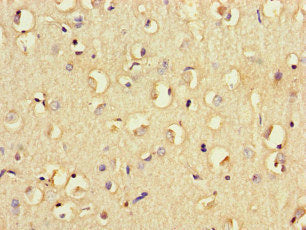 Immunohistochemistry of paraffin-embedded human brain tissue using FCGR2B Antibody at dilution of 1:100Rabbit anti-Human FCGR2B Polyclonal Antibody