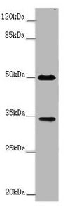 Western blot | All lanes: FCGR2B antibody at 2 μg/ml + Mouse liver tissue | Secondary | Goat polyclonal to rabbit IgG at 1/10000 dilution | Predicted band size: 35, 32, 34 kDa | Observed band size: 35, 50 kDaRabbit anti-Human FCGR2B Polyclonal Antibody