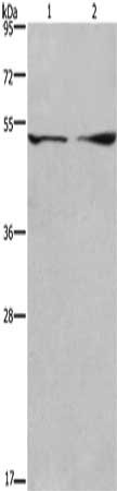 Gel: 8%SDS-PAGE, Lysate: 40 μg, Lane 1-2: 293T cells, mouse brain tissue, Primary antibody: DCTN2 Antibody(DCTN2 Antibody) at dilution 1/200, Secondary antibody: Goat anti rabbit IgG at 1/8000 dilution, Exposure time: 30 secondsRabbit anti-Human DCTN2 Polyclonal Antibody