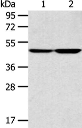 Gel: 8%SDS-PAGE, Lysate: 40 μg, Lane 1-2: A172 and 293T cell, Primary antibody: TEKT4 Antibody(TEKT4 Antibody) at dilution 1/200 dilution, Secondary antibody: Goat anti rabbit IgG at 1/8000 dilution, Exposure time: 1 minuteRabbit anti-Human TEKT4 Polyclonal Antibody