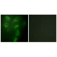 Immunofluorescence analysis of HeLa cells, using TRIM59 antibody.Rabbit anti-Human TRIM59 Polyclonal Antibody