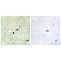 Immunohistochemistry analysis of paraffin-embedded human brain tissue using TRIM59 antibody.Rabbit anti-Human TRIM59 Polyclonal Antibody