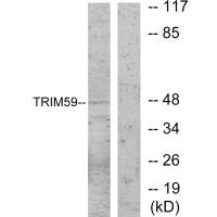 Western blot analysis of extracts from NIH-3T3 cells, using TRIM59 antibody.Rabbit anti-Human TRIM59 Polyclonal Antibody