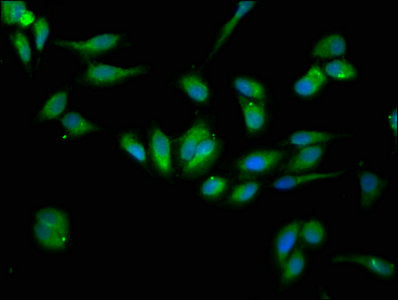 Immunofluorescence staining of Hela cells with HSP90B1 Antibody at 1:133, counter-stained with DAPI. The cells were fixed in 4% formaldehyde, permeabilized using 0.2% Triton X-100 and blocked in 10% normal Goat Serum. The cells were then incubated with the antibody overnight at 4°C. The secondary antibody was Alexa Fluor 488-congugated AffiniPure Goat Anti-Rabbit IgG(H+L).Rabbit anti-Human HSP90B1 Polyclonal Antibody