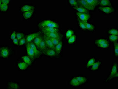 Immunofluorescence staining of HepG2 cells with HSPA1A Antibody at 1:66, counter-stained with DAPI. The cells were fixed in 4% formaldehyde, permeabilized using 0.2% Triton X-100 and blocked in 10% normal Goat Serum. The cells were then incubated with the antibody overnight at 4°C. The secondary antibody was Alexa Fluor 488-congugated AffiniPure Goat Anti-Rabbit IgG(H+L).Rabbit anti-Human HSPA1A Polyclonal Antibody