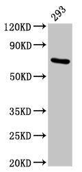 Western Blot  | Positive WB detected in: 293 whole cell lysate  | All lanes: HSPA1A antibody at 4.9µg/ml  | Secondary  | Goat polyclonal to rabbit IgG at 1/50000 dilution  | Predicted band size: 71, 64 kDa  | Observed band size: 71 kDaRabbit anti-Human HSPA1A Polyclonal Antibody