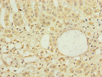 Immunohistochemistry of paraffin-embedded human adrenal gland tissue using DNAJB4 Antibody at dilution of 1:100Rabbit anti-Human DNAJB4 Polyclonal Antibody