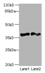 Western blot  | All lanes: DNAJB4 antibody at 2µg/ml  | Lane 1: Hela whole cell lysate  | Lane 2: Mouse heart tissue  | Secondary  | Goat polyclonal to rabbit IgG at 1/10000 dilution  | Predicted band size: 38 kDa  | Observed band size: 38 kDaRabbit anti-Human DNAJB4 Polyclonal Antibody