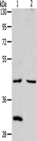 Gel: 10%SDS-PAGE, Lysate: 40 μg, Lane 1-2: Mouse kidney tissue, Mouse heart tissue, Primary antibody: NCEH1 Antibody(NCEH1 Antibody) at dilution 1/1300, Secondary antibody: Goat anti rabbit IgG at 1/8000 dilution, Exposure time: 2 minutesRabbit anti-Human NCEH1 Polyclonal Antibody