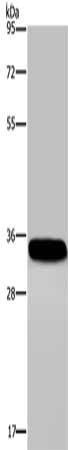 Gel: 8%SDS-PAGE, Lysate: 40 μg, Lane: Human normal lung tissue, Primary antibody: CA4 Antibody(CA4 Antibody) at dilution 1/300, Secondary antibody: Goat anti rabbit IgG at 1/8000 dilution, Exposure time: 40 seconds