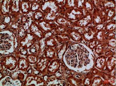 Immunohistochemical analysis of paraffin-embedded Human-kidney, antibody was diluted at 1:100Rabbit anti-Human EYA1/EYA4 Polyclonal Antibody