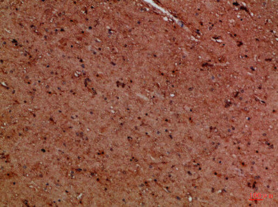 Immunohistochemical analysis of paraffin-embedded Human-brain, antibody was diluted at 1:100Rabbit anti-Human EYA1/EYA4 Polyclonal Antibody