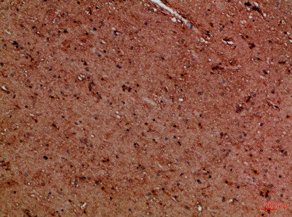 Immunohistochemical analysis of paraffin-embedded Human-brain, antibody was diluted at 1:100Rabbit anti-Human EYA1/EYA4 Polyclonal Antibody