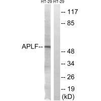 Western blot analysis of extracts from HT-29 cells, using APLF (Ab-116) antibody.Rabbit anti-Human APLF Polyclonal Antibody