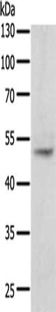Gel: 10%SDS-PAGE, Lysate: 50 μg, Lane: Human fetal kidney tissue, Primary antibody: TERF1 Antibody(TERF1 Antibody) at dilution 1/400, Secondary antibody: Goat anti rabbit IgG at 1/8000 dilution, Exposure time: 5 minutes