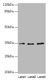 Western blot  | All lanes: AZGP1 antibody at 4µg/ml  | Lane 1: PC-3 whole cell lysate  | Lane 2: HepG2 whole cell lysate  | Lane 3: K562 whole cell lysate  | Secondary  | Goat polyclonal to rabbit IgG at 1/10000 dilution  | Predicted band size: 35 kDa  | Observed band size: 35 kDa