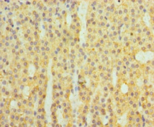 Immunohistochemistry of paraffin-embedded human adrenal gland tissue using CFB Antibody at dilution of 1:100Rabbit anti-Human CFB Polyclonal Antibody