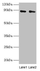 Western blot  | All lanes: CFB antibody at 2µg/ml  | Lane 1: K562 whole cell lysate  | Lane 2: HepG2 whole cell lysate  | Secondary  | Goat polyclonal to rabbit IgG at 1/10000 dilution  | Predicted band size: 86, 69 kDa  | Observed band size: 86 kDaRabbit anti-Human CFB Polyclonal Antibody