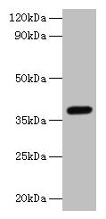 Western blot  | All lanes: LRG1 antibody at 2µg/ml + Mouse liver tissue  | Secondary  | Goat polyclonal to rabbit IgG at 1/10000 dilution  | Predicted band size: 39 kDa  | Observed band size: 39 kDa