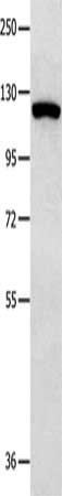 Gel: 8%SDS-PAGE, Lysate: 50 μg, Lane: 823 cells, Primary antibody: MVP Antibody(MVP Antibody) at dilution 1/350, Secondary antibody: Goat anti rabbit IgG at 1/8000 dilution, Exposure time: 1 secondRabbit anti-Human MVP Polyclonal Antibody