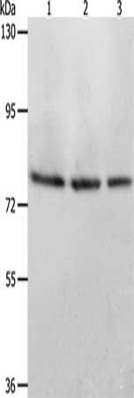 Gel: 8%SDS-PAGE, Lysate: 40 μg, Lane 1-3: Mouse stomach tissue, Mouse liver tissue, Mouse kidney tissue, Primary antibody: ACOX1 Antibody(ACOX1 Antibody) at dilution 1/350, Secondary antibody: Goat anti rabbit IgG at 1/8000 dilution, Exposure time: 1 minute