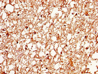 IHC image of AQP4 Antibody diluted at 1:370 and staining in paraffin-embedded human brain tissue performed on a Leica BondTM system. After dewaxing and hydration, antigen retrieval was mediated by high pressure in a citrate buffer (pH 6.0). Section was blocked with 10% normal goat serum 30min at RT. Then primary antibody (1% BSA) was incubated at 4°C overnight. The primary is detected by a biotinylated secondary antibody and visualized using an HRP conjugated SP system.Rabbit anti-Human AQP4 Polyclonal Antibody
