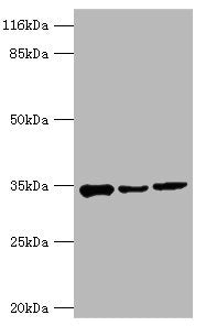 Western blot  | All lanes: AQP4 antibody at 2µg/ml  | Lane 1: Mouse heart tissue  | Lane 2: Mouse brain tissue  | Lane 3: Mouse kidney tissue  | Secondary  | Goat polyclonal to rabbit IgG at 1/10000 dilution  | Predicted band size: 35, 33 kDa  | Observed band size: 35 kDaRabbit anti-Human AQP4 Polyclonal Antibody
