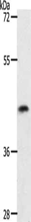 Gel: 8%SDS-PAGE, Lysate: 40 μg, Lane: 231 cells, Primary antibody: PLAT Antibody(PLAT Antibody) at dilution 1/450, Secondary antibody: Goat anti rabbit IgG at 1/8000 dilution, Exposure time: 10 minutesRabbit anti-Human PLAT Polyclonal Antibody