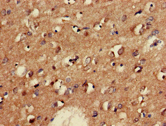 Immunohistochemistry of paraffin-embedded human brain tissue using GAD2 Antibody at dilution of 1:100Rabbit anti-Human GAD2 Polyclonal Antibody