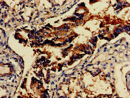 Immunohistochemistry of paraffin-embedded human lung tissue using GAD2 Antibody at dilution of 1:100Rabbit anti-Human GAD2 Polyclonal Antibody