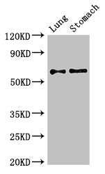 Western Blot | Positive WB detected in: Mouse lung tissue, Mouse stomach tissue | All lanes: GAD2 antibody at 2.7μg/ml | Secondary | Goat polyclonal to rabbit IgG at 1/50000 dilution | Predicted band size: 66 kDa | Observed band size: 66 kDaRabbit anti-Human GAD2 Polyclonal Antibody