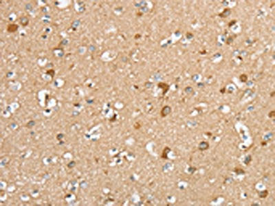 The image on the left is immunohistochemistry of paraffin-embedded Human brain  tissue using SERINC2 Antibody(SERINC2 Antibody) at dilution 1/20, on the right is treated with synthetic peptide. (Original magnification: ×200)Rabbit anti-Human SERINC2 Polyclonal Antibody