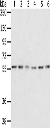 Gel: 8%SDS-PAGE, Lysate: 40 μg, Lane 1-6: K562 cells, NIH/3T3 cells, Jurkat cells, 293T cells, 231 cells, hepg2 cells, Primary antibody: SERINC2 Antibody(SERINC2 Antibody) at dilution 1/200, Secondary antibody: Goat anti rabbit IgG at 1/8000 dilution, Exposure time: 1 minuteRabbit anti-Human SERINC2 Polyclonal Antibody