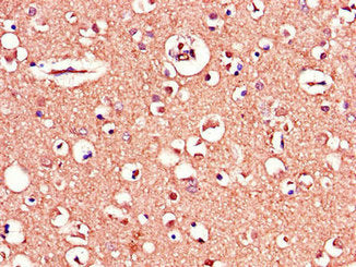 Immunohistochemistry of paraffin-embedded human brain tissue using MAPT Antibody at dilution of 1:100