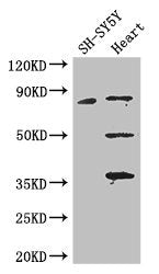 Western Blot | Positive WB detected in: SH-SY5Y whole cell lysate, Mouse heart tissue | All lanes: MAPT antibody at 3.25μg/ml | Secondary | Goat polyclonal to rabbit IgG at 1/50000 dilution | Predicted band size: 79, 37, 33, 40, 43, 41, 46, 81 kDa | Observed band size: 79, 50, 36 kDa