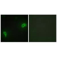 Immunofluorescence analysis of HepG2 cells, using DOK7 antibody.Rabbit anti-Human DOK7 Polyclonal Antibody