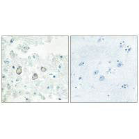 Immunohistochemistry analysis of paraffin-embedded human brain tissue using DOK7 antibody.Rabbit anti-Human DOK7 Polyclonal Antibody