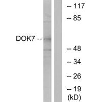 Western blot analysis of extracts from mouse brain cells, using DOK7 antibody.Rabbit anti-Human DOK7 Polyclonal Antibody