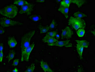 Immunofluorescent analysis of U251 cells using SERPINE1 Antibody at dilution of 1:100 and Alexa Fluor 488-congugated AffiniPure Goat Anti-Rabbit IgG(H+L)Rabbit anti-Human SERPINE1 Polyclonal Antibody
