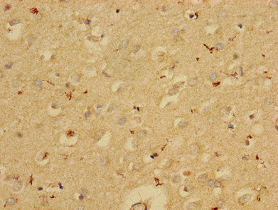 Immunohistochemistry of paraffin-embedded human brain tissue using SERPINE1 Antibody at dilution of 1:100Rabbit anti-Human SERPINE1 Polyclonal Antibody
