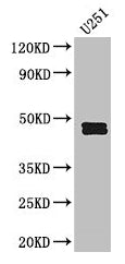 Western Blot  | Positive WB detected in: U251 whole cell lysate  | All lanes: SERPINE1 antibody at 2.5µg/ml  | Secondary  | Goat polyclonal to rabbit IgG at 1/50000 dilution  | Predicted band size: 46, 44 kDa  | Observed band size: 46, 44 kDaRabbit anti-Human SERPINE1 Polyclonal Antibody