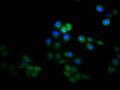 Immunofluorescence staining of Hela cells with the antibody at 1:133, counter-stained with DAPI. The cells were fixed in 4% formaldehyde, permeabilized using 0.2% Triton X-100 and blocked in 10% normal Goat Serum. The cells were then incubated with the antibody overnight at 4°C. The secondary antibody was Alexa Fluor 488-congugated AffiniPure Goat Anti-Rabbit IgG(H+L).