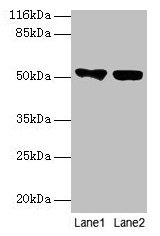 Western blot  | All lanes: KRT8 antibody at 2µg/ml  | Lane 1: A549 whole cell lysate  | Lane 2: MCF-7 whole cell lysate  | Secondary  | Goat polyclonal to rabbit IgG at 1/10000 dilution  | Predicted band size: 54, 57 kDa  | Observed band size: 54 kDa
