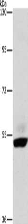 Gel: 6%SDS-PAGE, Lysate: 40 μg, Lane: Human placenta tissue, Primary antibody: STK40 Antibody(STK40 Antibody) at dilution 1/400, Secondary antibody: Goat anti rabbit IgG at 1/8000 dilution, Exposure time: 2 minutesRabbit anti-Human STK40 Polyclonal Antibody