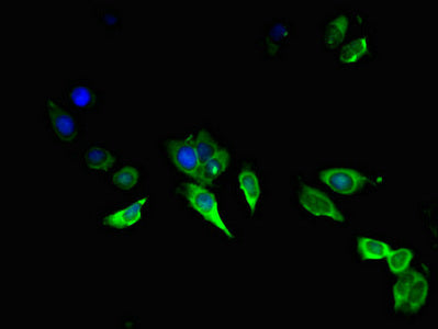 Immunofluorescent analysis of Hela cells using AREG Antibody at dilution of 1:100 and Alexa Fluor 488-congugated AffiniPure Goat Anti-Rabbit IgG(H+L)Rabbit anti-Human AREG Polyclonal Antibody