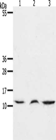 Gel: 15%SDS-PAGE, Lysate: 40 μg, Lane 1-3: Mouse lung tissue, Mouse thymus tissue, human fetal muscle tissue, Primary antibody: CCL17 Antibody(CCL17 Antibody) at dilution 1/1300, Secondary antibody: Goat anti rabbit IgG at 1/8000 dilution, Exposure time: 45 secondsRabbit anti-Human CCL17 Polyclonal Antibody